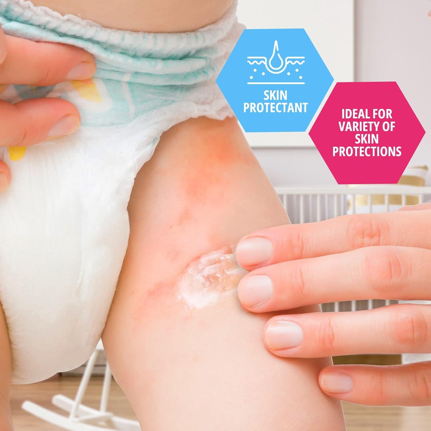 imageMED PRIDE Baby Petroleum Jelly for Newborns  Skin Protectant ampamp Moisturizer for Dry Skin ampamp Diaper Rash  13 Oz 13 Ounce Blue  Baby ClearBlue  Baby